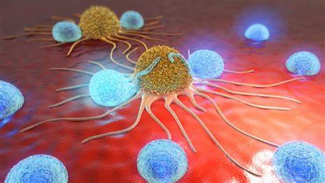 生存25年！NK细胞在乳腺癌、肺癌、结直肠癌以及卵巢癌中势不可挡