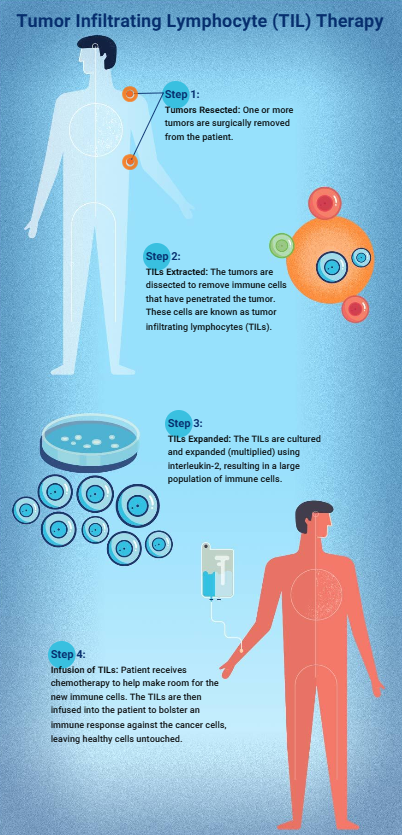 实体瘤克星！TIL疗法在黑色素瘤、非小细胞肺癌、肝细胞癌、宫颈癌中大放异彩