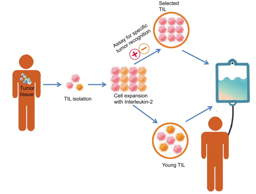 美国370万一针的TIL细胞疗法上市！国内外开展研究“热潮”